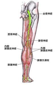 椎間板ヘルニア と 坐骨神経痛 の関係 椎間板ヘルニアによる腰痛から解放されるための治療法 予防法