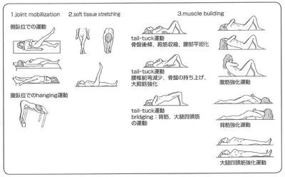 いろいろな腰痛体操 Williams体操 Kendall Jenkinsの運動 Mckenzie法 他 椎間板ヘルニアによる腰痛から解放されるための治療法 予防法
